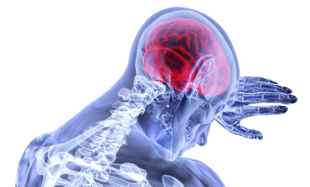 Survivors: Recovery after a Stroke